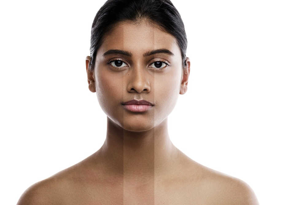 Premium Qualität mit restylane dermal filler bei MorySkin